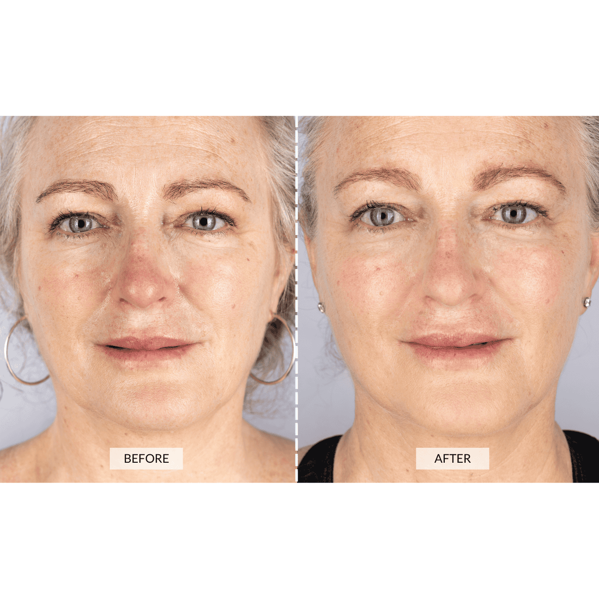 CurrentBody Skin LED Lichttherapie Maske Angebot