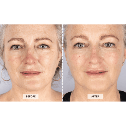CurrentBody Skin LED Lichttherapie Maske Angebot